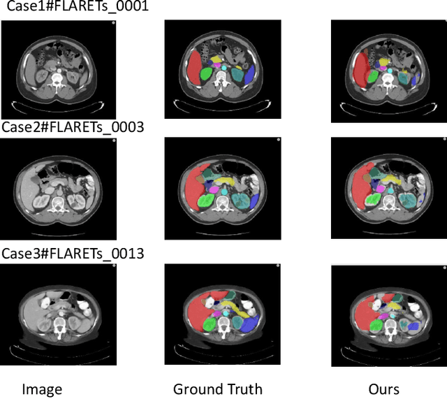 Figure 4 for Abdominal multi-organ segmentation in CT using Swinunter