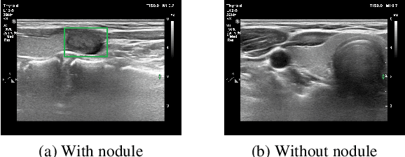 Figure 1 for Towards Trust of Explainable AI in Thyroid Nodule Diagnosis