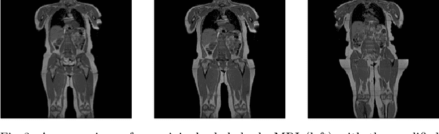 Figure 4 for Metrics to Quantify Global Consistency in Synthetic Medical Images