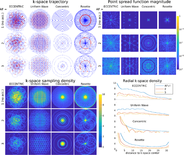 Figure 2 for ECCENTRIC: a fast and unrestrained approach for high-resolution in vivo metabolic imaging at ultra-high field MR