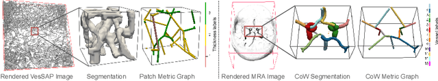 Figure 3 for 3D Vessel Graph Generation Using Denoising Diffusion