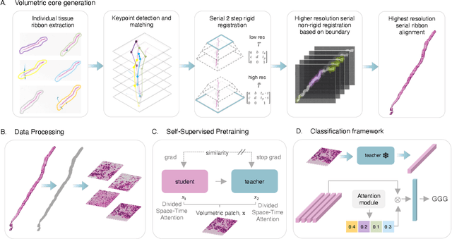 Figure 1 for Digital Volumetric Biopsy Cores Improve Gleason Grading of Prostate Cancer Using Deep Learning