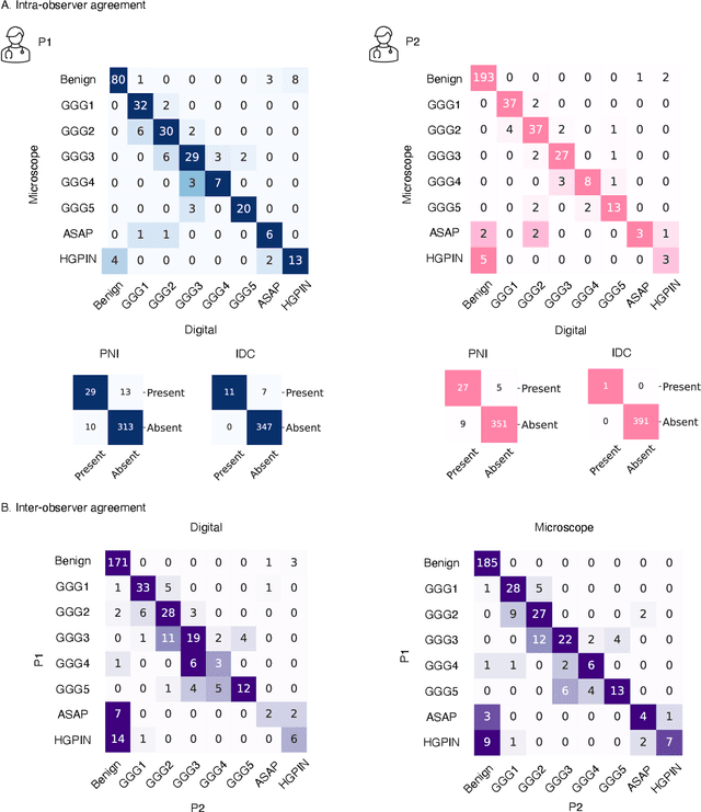 Figure 3 for Digital Volumetric Biopsy Cores Improve Gleason Grading of Prostate Cancer Using Deep Learning