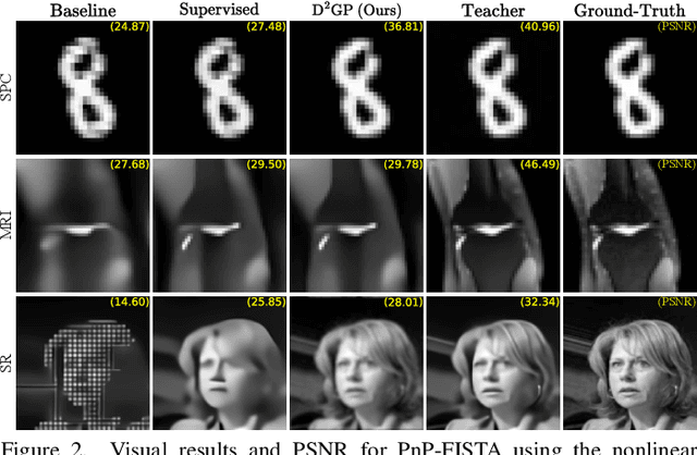 Figure 2 for Deep Distillation Gradient Preconditioning for Inverse Problems