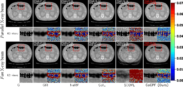 Figure 1 for CoCPF: Coordinate-based Continuous Projection Field for Ill-Posed Inverse Problem in Imaging