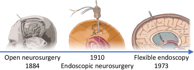 Figure 1 for From Rigid to Soft Robotic Approaches for Minimally Invasive Neurosurgery