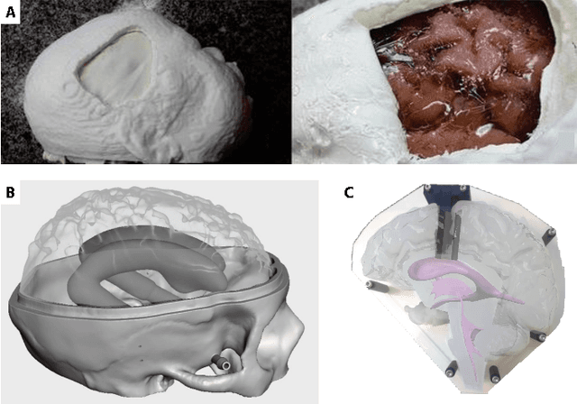 Figure 2 for From Rigid to Soft Robotic Approaches for Minimally Invasive Neurosurgery