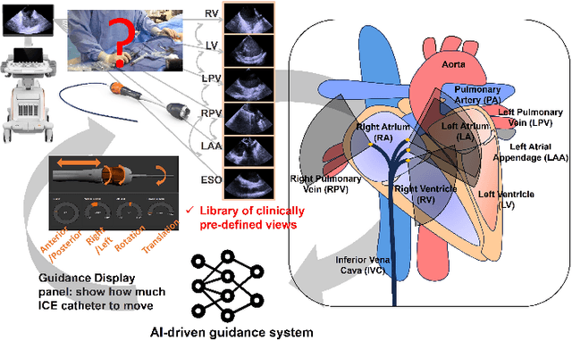 Figure 1 for AI-driven View Guidance System in Intra-cardiac Echocardiography Imaging