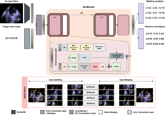 Figure 4 for AI-driven View Guidance System in Intra-cardiac Echocardiography Imaging