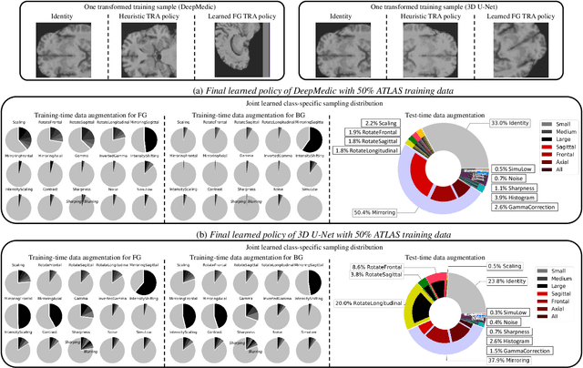 Figure 4 for Joint Optimization of Class-Specific Training- and Test-Time Data Augmentation in Segmentation