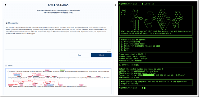 Figure 4 for Information Extraction from Clinical Notes: Are We Ready to Switch to Large Language Models?