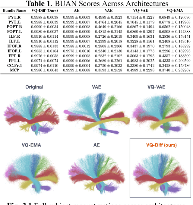 Figure 1 for Differentiable VQ-VAE's for Robust White Matter Streamline Encodings