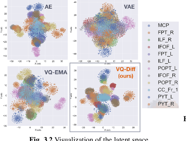 Figure 3 for Differentiable VQ-VAE's for Robust White Matter Streamline Encodings