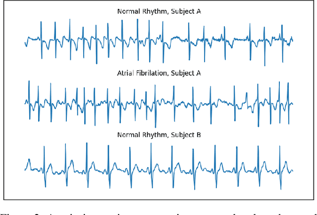 Figure 3 for Contrastive Learning Is Not Optimal for Quasiperiodic Time Series