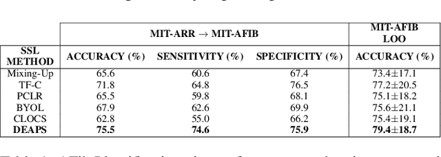 Figure 2 for Contrastive Learning Is Not Optimal for Quasiperiodic Time Series