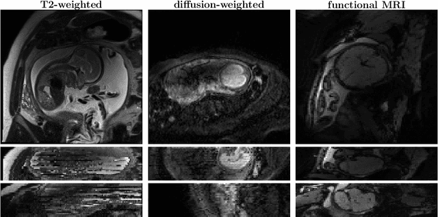 Figure 1 for Fetal-BET: Brain Extraction Tool for Fetal MRI