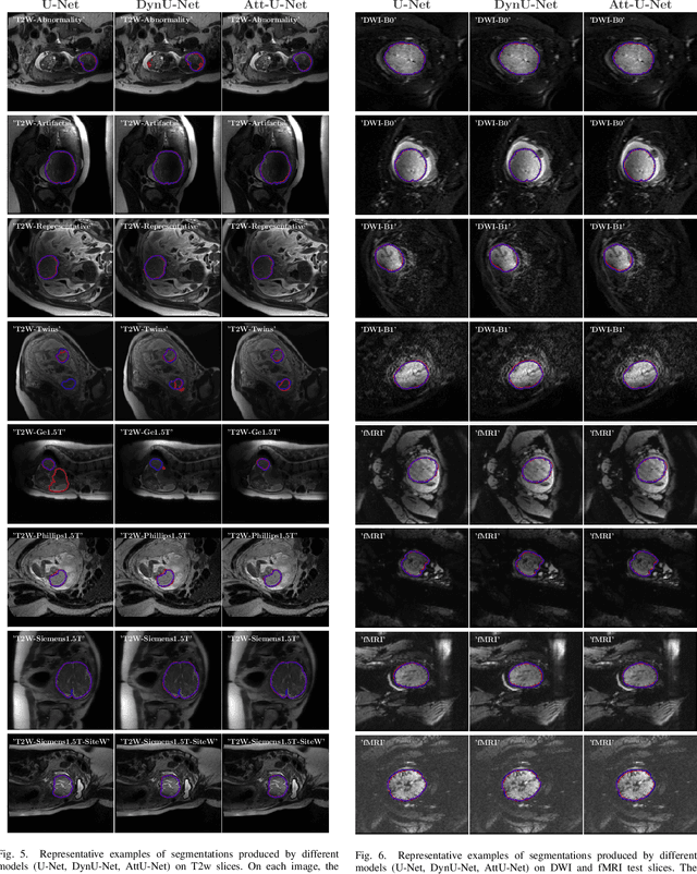 Figure 4 for Fetal-BET: Brain Extraction Tool for Fetal MRI