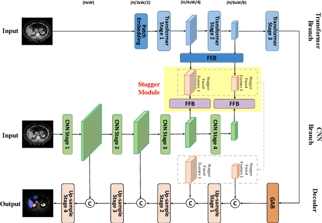 Figure 4 for Rethinking Information Loss in Medical Image Segmentation with Various-sized Targets