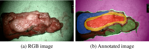 Figure 4 for Robust Tumor Segmentation with Hyperspectral Imaging and Graph Neural Networks