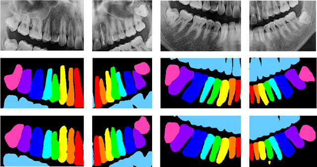 Figure 4 for Intergrated Segmentation and Detection Models for Dentex Challenge 2023