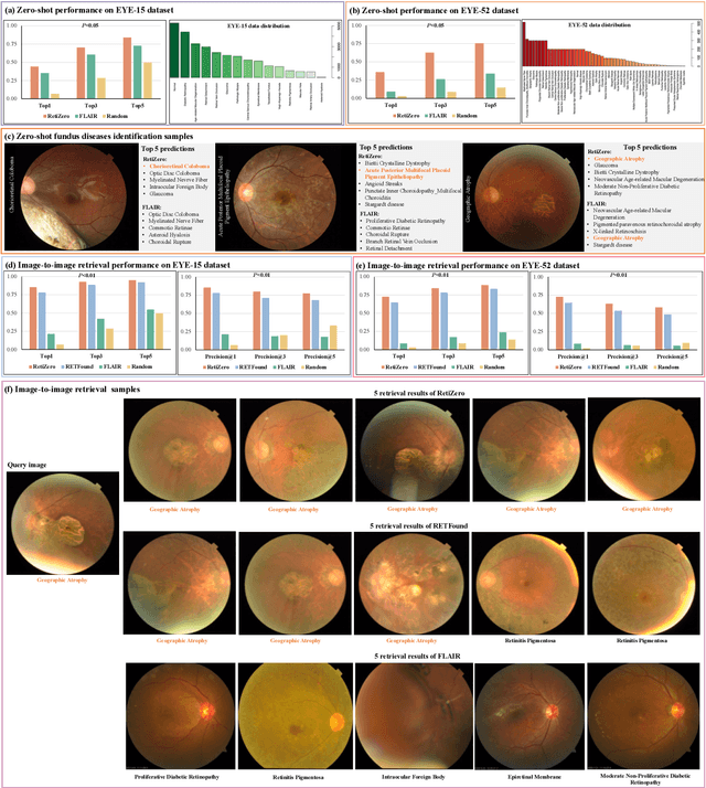 Figure 2 for Common and Rare Fundus Diseases Identification Using Vision-Language Foundation Model with Knowledge of Over 400 Diseases