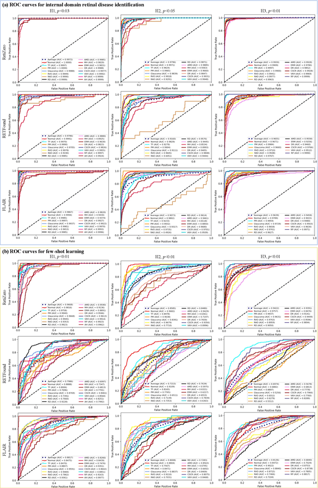 Figure 4 for Common and Rare Fundus Diseases Identification Using Vision-Language Foundation Model with Knowledge of Over 400 Diseases