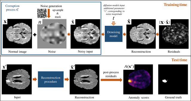 Figure 1 for The role of noise in denoising models for anomaly detection in medical images