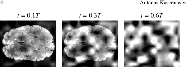 Figure 3 for The role of noise in denoising models for anomaly detection in medical images