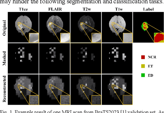 Figure 1 for Enhanced Self-supervised Learning for Multi-modality MRI Segmentation and Classification: A Novel Approach Avoiding Model Collapse