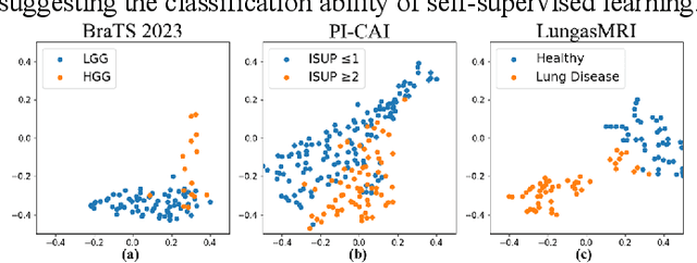 Figure 2 for Enhanced Self-supervised Learning for Multi-modality MRI Segmentation and Classification: A Novel Approach Avoiding Model Collapse