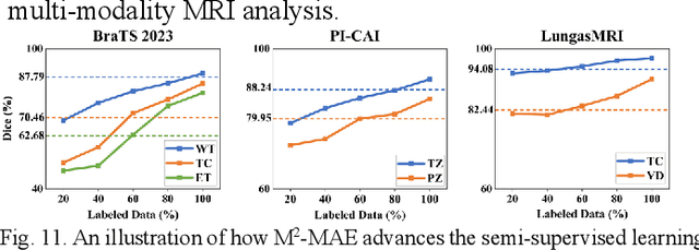 Figure 3 for Enhanced Self-supervised Learning for Multi-modality MRI Segmentation and Classification: A Novel Approach Avoiding Model Collapse