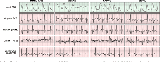 Figure 4 for Region-Disentangled Diffusion Model for High-Fidelity PPG-to-ECG Translation