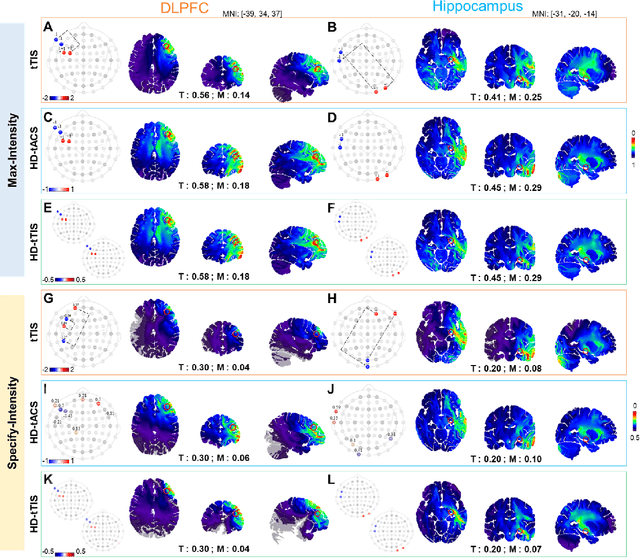 Figure 4 for Multi-objective optimization via evolutionary algorithm (MOVEA) for high-definition transcranial electrical stimulation of the human brain