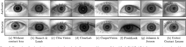 Figure 4 for Privacy-Safe Iris Presentation Attack Detection