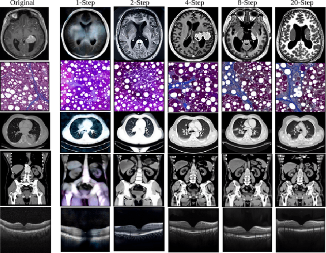 Figure 1 for Leapfrog Latent Consistency Model (LLCM) for Medical Images Generation