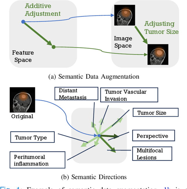 Figure 1 for Bayesian Random Semantic Data Augmentation for Medical Image Classification