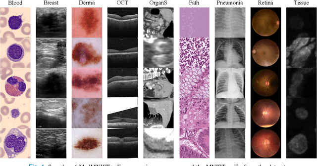 Figure 4 for Bayesian Random Semantic Data Augmentation for Medical Image Classification