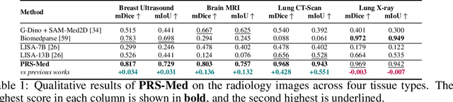 Figure 1 for PRS-Med: Position Reasoning Segmentation with Vision-Language Model in Medical Imaging