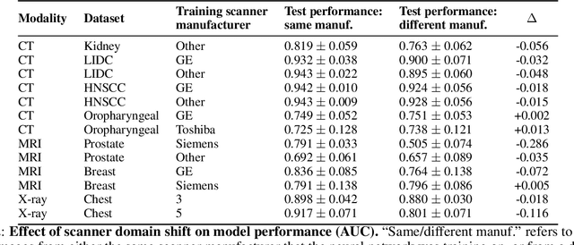 Figure 3 for The Impact of Scanner Domain Shift on Deep Learning Performance in Medical Imaging: an Experimental Study