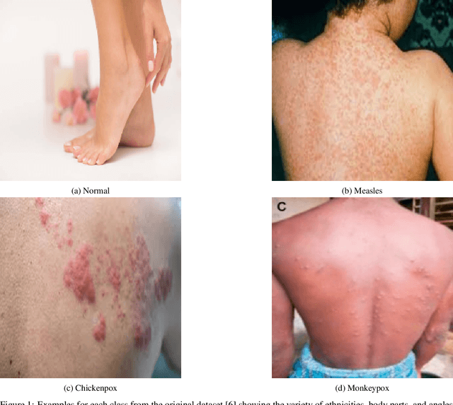 Figure 2 for Enhancing Orthopox Image Classification Using Hybrid Machine Learning and Deep Learning Models