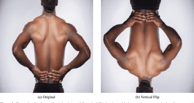 Figure 3 for Enhancing Orthopox Image Classification Using Hybrid Machine Learning and Deep Learning Models