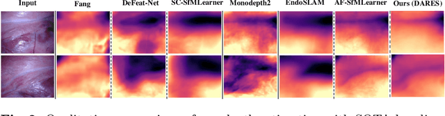 Figure 3 for DARES: Depth Anything in Robotic Endoscopic Surgery with Self-supervised Vector-LoRA of the Foundation Model