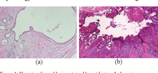 Figure 1 for A lightweight deep learning pipeline with DRDA-Net and MobileNet for breast cancer classification