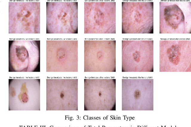 Figure 3 for Optimizing Deep Learning for Skin Cancer Classification: A Computationally Efficient CNN with Minimal Accuracy Trade-Off