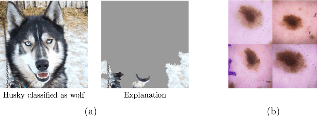 Figure 1 for A Causal Framework to Unify Common Domain Generalization Approaches