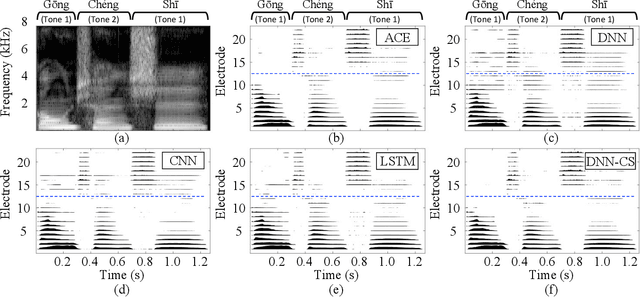 Figure 2 for ElectrodeNet -- A Deep Learning Based Sound Coding Strategy for Cochlear Implants