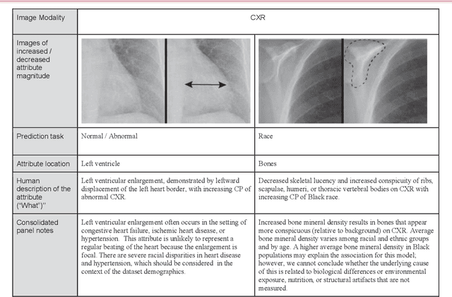 Figure 3 for Using generative AI to investigate medical imagery models and datasets