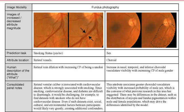 Figure 4 for Using generative AI to investigate medical imagery models and datasets