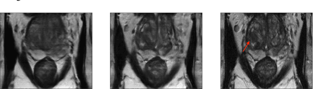 Figure 1 for On the Feasibility of Machine Learning Augmented Magnetic Resonance for Point-of-Care Identification of Disease