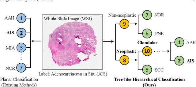 Figure 1 for Diagnostic Text-guided Representation Learning in Hierarchical Classification for Pathological Whole Slide Image